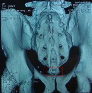 CT01 Pre-surgery