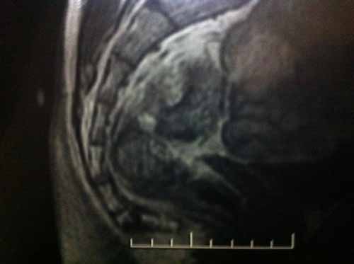 mri scan
