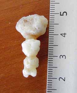 Astrid's coccyx