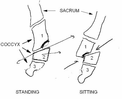 coccyx luxation