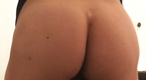 protruding sacrum