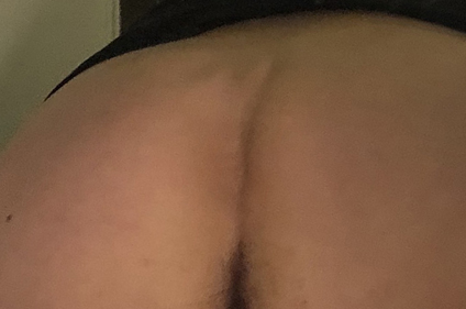 sacrum after 1 year 2