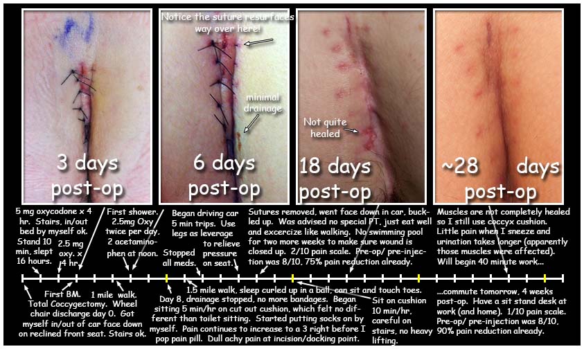 timeline post-op