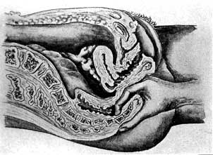 Palpation of the coccyx