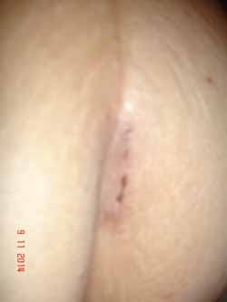 helen 3