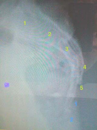 x-ray