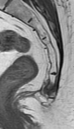 John's MRI