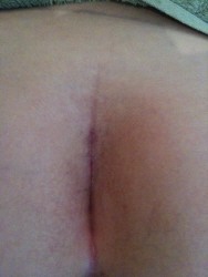 5dayscar