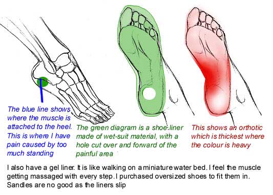 plantar fasciitis, and shoe liners to relieve it