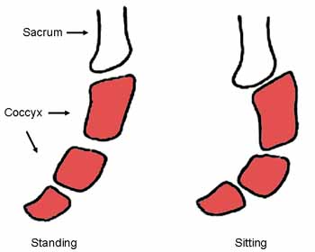dislocating coccyx