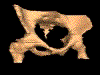 rotating pelvis