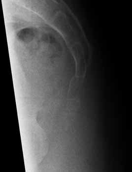 coccyx while standing
