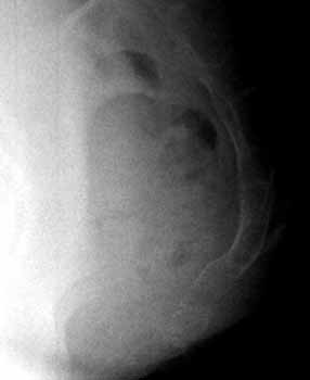coccyx while sitting