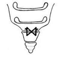 repair of coccyx joint